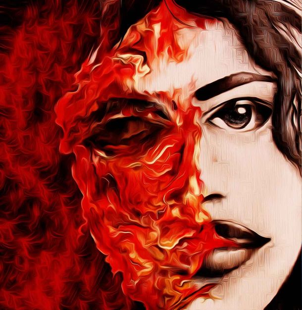 Acid thrown on minor girl in Delhi, suffers burns on face, eyes; one detained