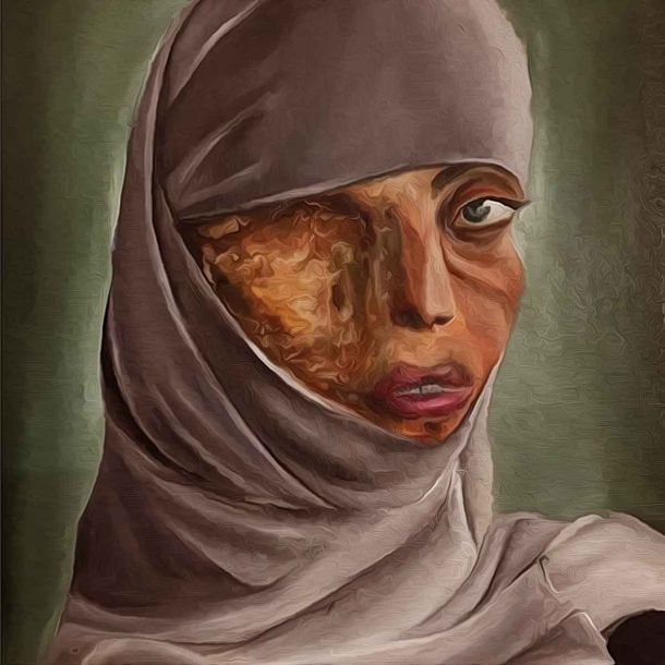 Muslim throws acid at his ex-wife for refusing to halala